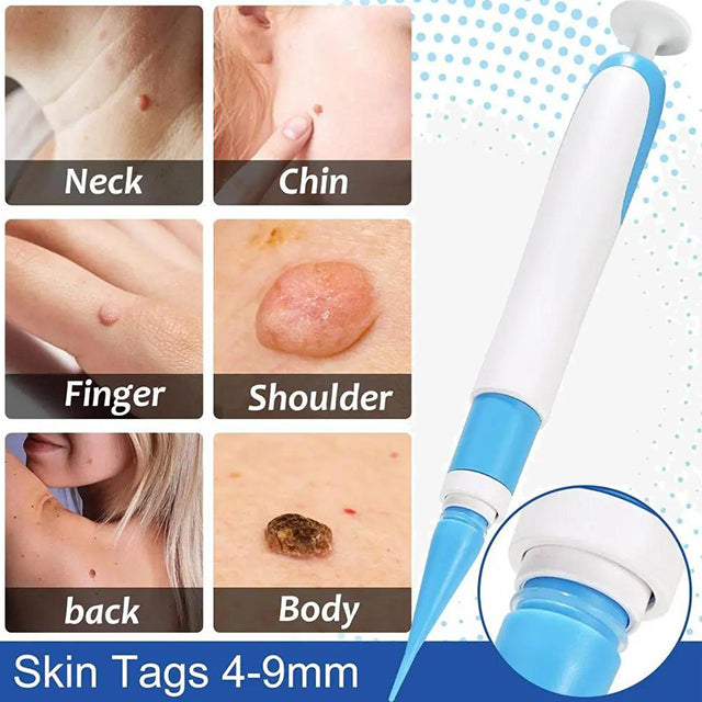 Auto Skin Tags Removal Tool Device with Cleansing Wipes – Safe, Painless Skin Tag Remover Kit