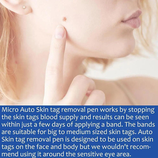 Auto Skin Tags Removal Tool Device with Cleansing Wipes – Safe, Painless Skin Tag Remover Kit