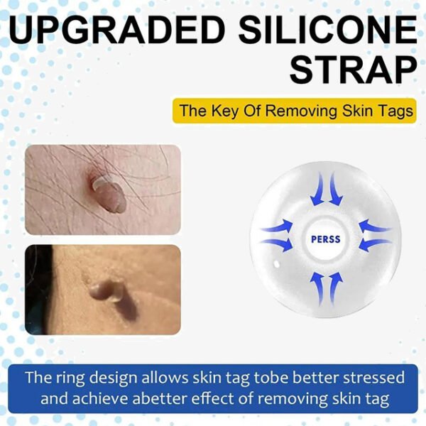 Auto Skin Tags Removal Tool Device with Cleansing Wipes – Safe, Painless Skin Tag Remover Kit