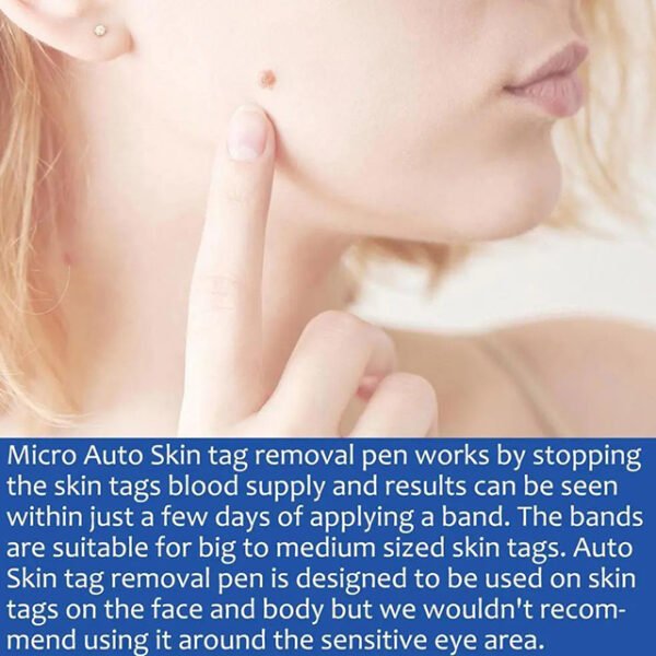 Auto Skin Tags Removal Tool Device with Cleansing Wipes – Safe, Painless Skin Tag Remover Kit